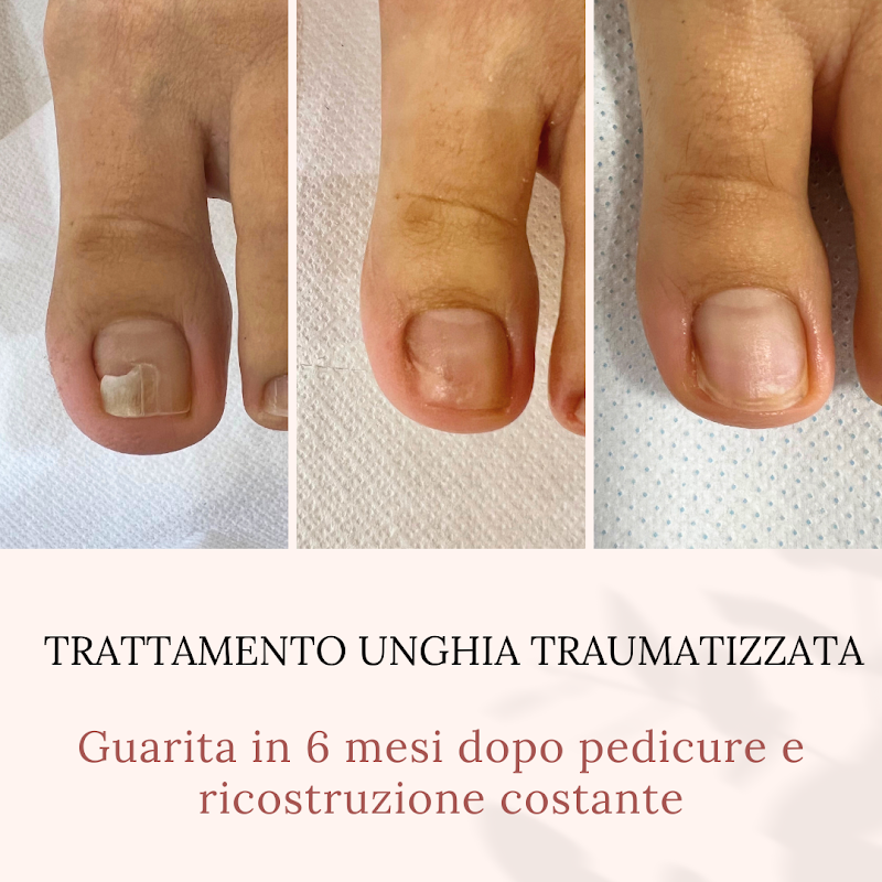 La Boutique Unghie Sane e Forti - Nettuno — estetista a Anzio