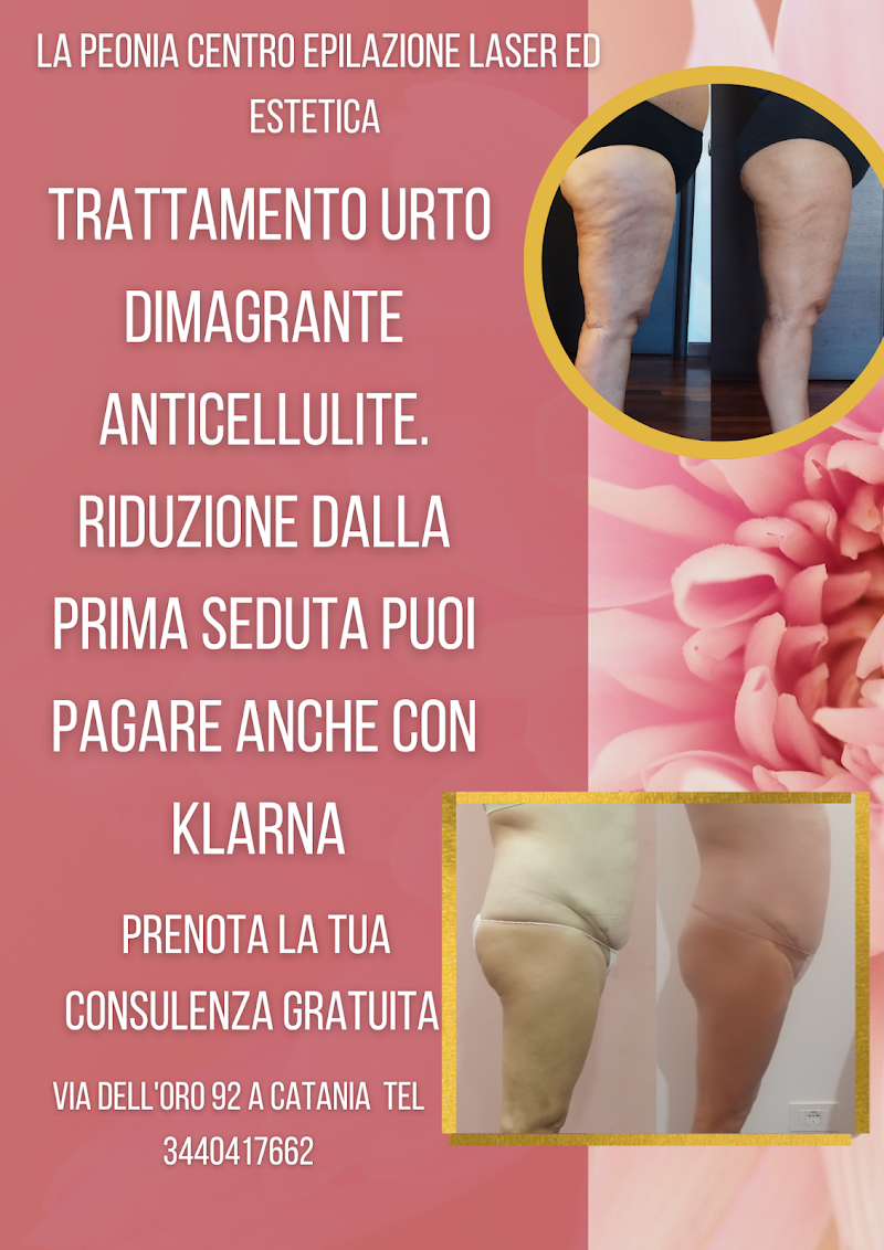 La Peonia Centro Epilazione Laser ed Estetica — estetista a Catania