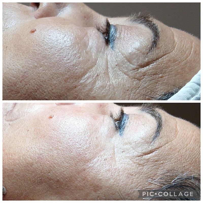 Dermo Age Reverse - Istituto Estetico SECRET SOIN — estetista a Abbiategrasso
