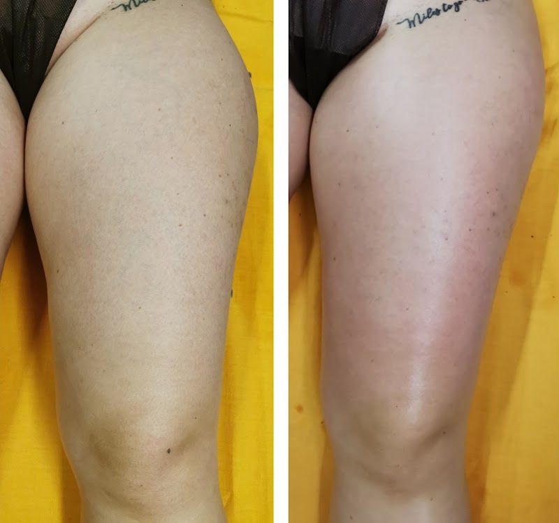 Beauty laboratoriodi bellezza — estetista a Canicattì